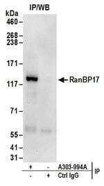 RanBP17 Antibody in Western Blot (WB)
