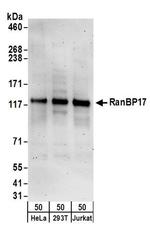 RanBP17 Antibody in Western Blot (WB)