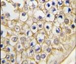 TRPV3 Antibody in Immunohistochemistry (IHC)