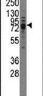 TRPV3 Antibody in Western Blot (WB)