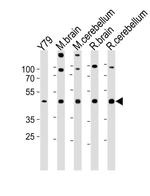 RAX Antibody in Western Blot (WB)