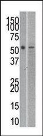 RUVBL2 Antibody in Western Blot (WB)