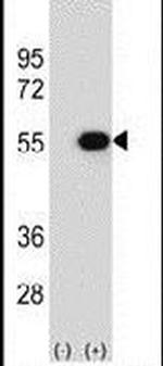 RUVBL2 Antibody in Western Blot (WB)