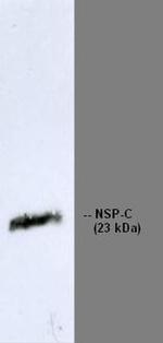 RTN1 Antibody in Western Blot (WB)