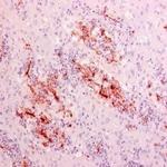 Rhizopus arrhizus Antibody in Immunohistochemistry (Paraffin) (IHC (P))