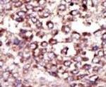 Ribophorin II Antibody in Immunohistochemistry (IHC)