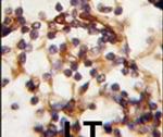 RICTOR Antibody in Immunohistochemistry (IHC)