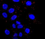 Rictor Antibody in Immunocytochemistry (ICC/IF)