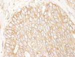 Rictor Antibody in Immunohistochemistry (IHC)