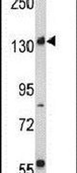 RICTOR Antibody in Western Blot (WB)