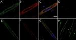 RyR1 Antibody in Immunocytochemistry (ICC/IF)