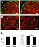 Ryanodine Receptor Antibody in Immunohistochemistry (IHC)