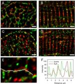 Ryanodine Receptor Antibody in Immunohistochemistry (IHC)