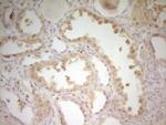 S100A1 Antibody in Immunohistochemistry (Paraffin) (IHC (P))