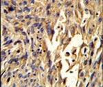 S100A10 Antibody in Immunohistochemistry (IHC)