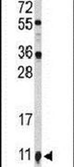 S100A10 Antibody in Western Blot (WB)