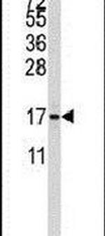 S100A11 Antibody in Western Blot (WB)