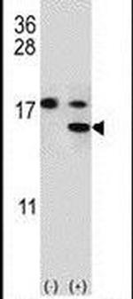S100A11 Antibody in Western Blot (WB)