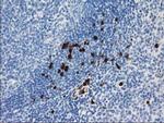 S100A12 Antibody in Immunohistochemistry (Paraffin) (IHC (P))