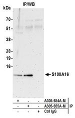 S100A16 Polyclonal Antibody