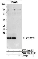 S100A16 Antibody in Western Blot (WB)