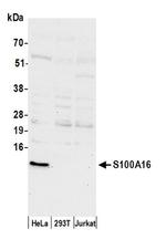 S100A16 Antibody in Western Blot (WB)