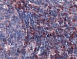 S100A4 Antibody in Immunohistochemistry (IHC)