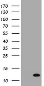 S100A6 Antibody in Western Blot (WB)