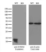 S100A6 Antibody in Western Blot (WB)