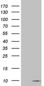 S100A6 Antibody in Western Blot (WB)