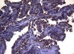S100A9 Antibody in Immunohistochemistry (Paraffin) (IHC (P))