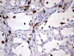 S100A9 Antibody in Immunohistochemistry (Paraffin) (IHC (P))