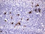 S100A9 Antibody in Immunohistochemistry (Paraffin) (IHC (P))