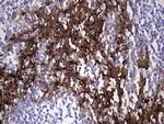 S100A9 Antibody in Immunohistochemistry (Paraffin) (IHC (P))