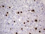 S100A9 Antibody in Immunohistochemistry (Paraffin) (IHC (P))