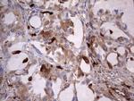 S100A9 Antibody in Immunohistochemistry (Paraffin) (IHC (P))