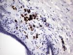 S100A9 Antibody in Immunohistochemistry (Paraffin) (IHC (P))