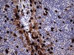 S100A9 Antibody in Immunohistochemistry (Paraffin) (IHC (P))