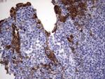 S100A9 Antibody in Immunohistochemistry (Paraffin) (IHC (P))