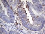 S100A9 Antibody in Immunohistochemistry (Paraffin) (IHC (P))