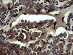 S100A9 Antibody in Immunohistochemistry (Paraffin) (IHC (P))