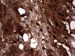 S100A9 Antibody in Immunohistochemistry (Paraffin) (IHC (P))