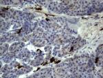 S100A9 Antibody in Immunohistochemistry (Paraffin) (IHC (P))
