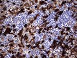S100A9 Antibody in Immunohistochemistry (Paraffin) (IHC (P))