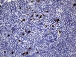 S100A9 Antibody in Immunohistochemistry (Paraffin) (IHC (P))