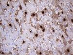S100A9 Antibody in Immunohistochemistry (Paraffin) (IHC (P))