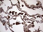 S100A9 Antibody in Immunohistochemistry (Paraffin) (IHC (P))