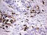S100A9 Antibody in Immunohistochemistry (Paraffin) (IHC (P))