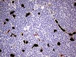 S100A9 Antibody in Immunohistochemistry (Paraffin) (IHC (P))