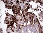 S100A9 Antibody in Immunohistochemistry (Paraffin) (IHC (P))